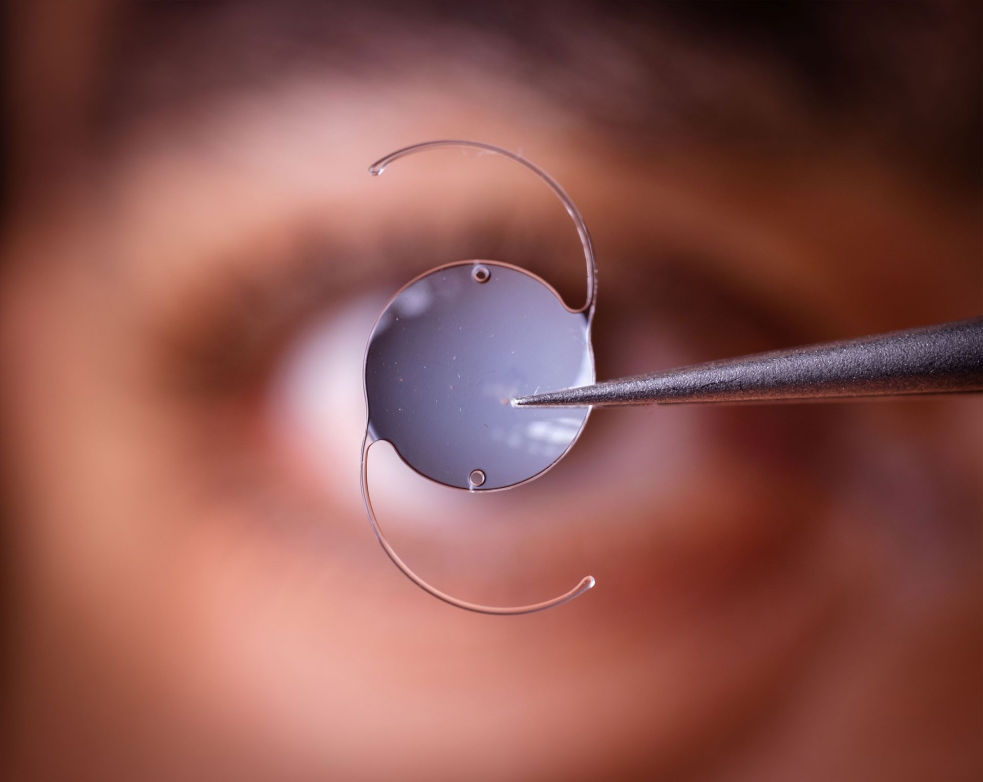 cataract surgery in Nashville and Brentwood