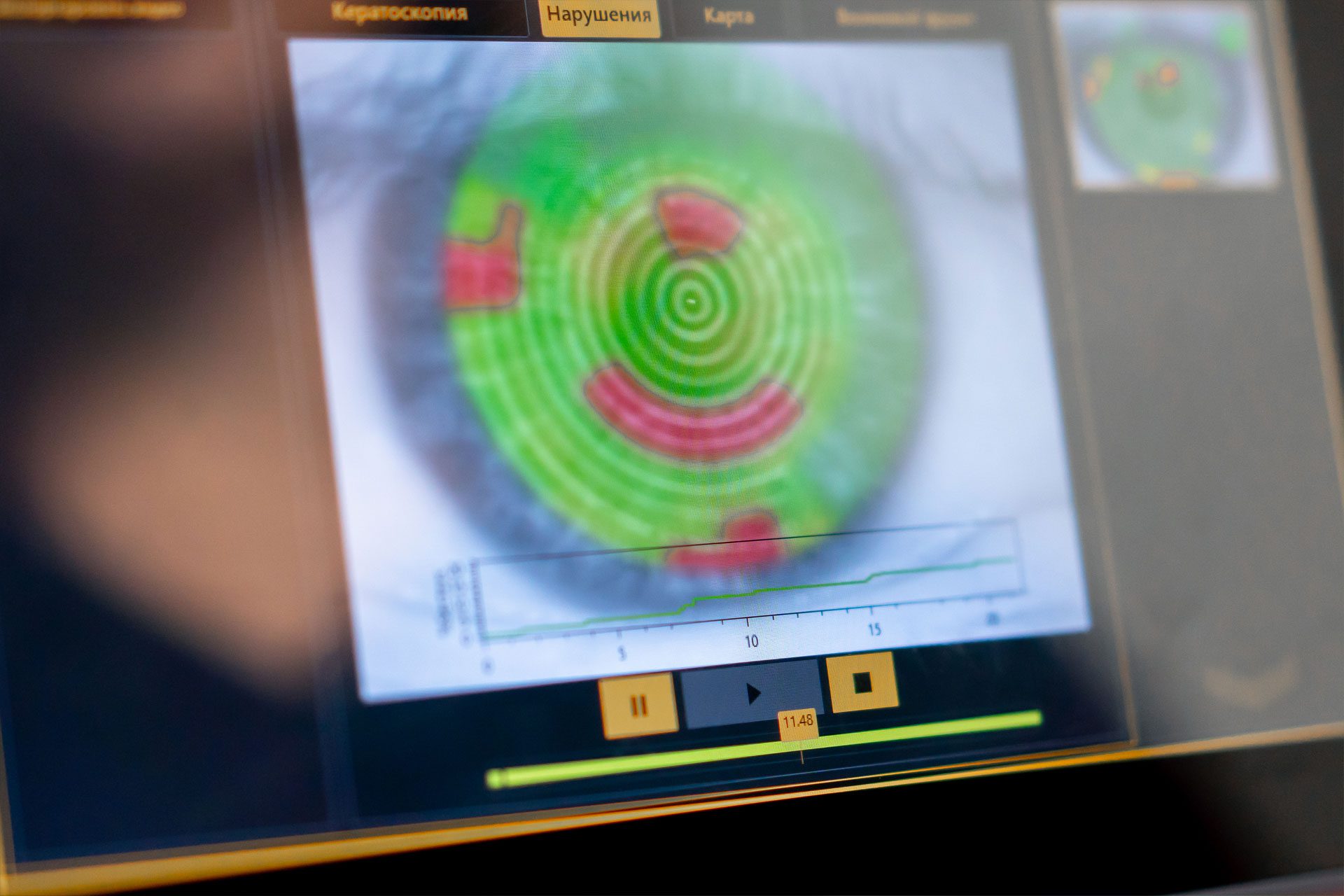 diagnostic eye screening with eye doctors in Nashville, TN