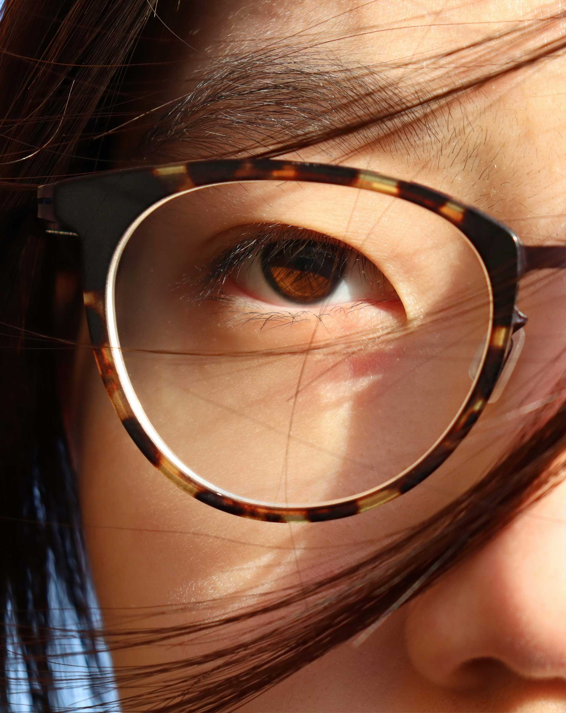 eye disease management | eye specialist Nashville, TN