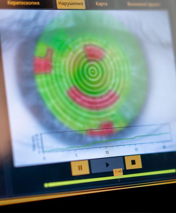 diagnostic eye screening with eye doctors in Nashville, TN